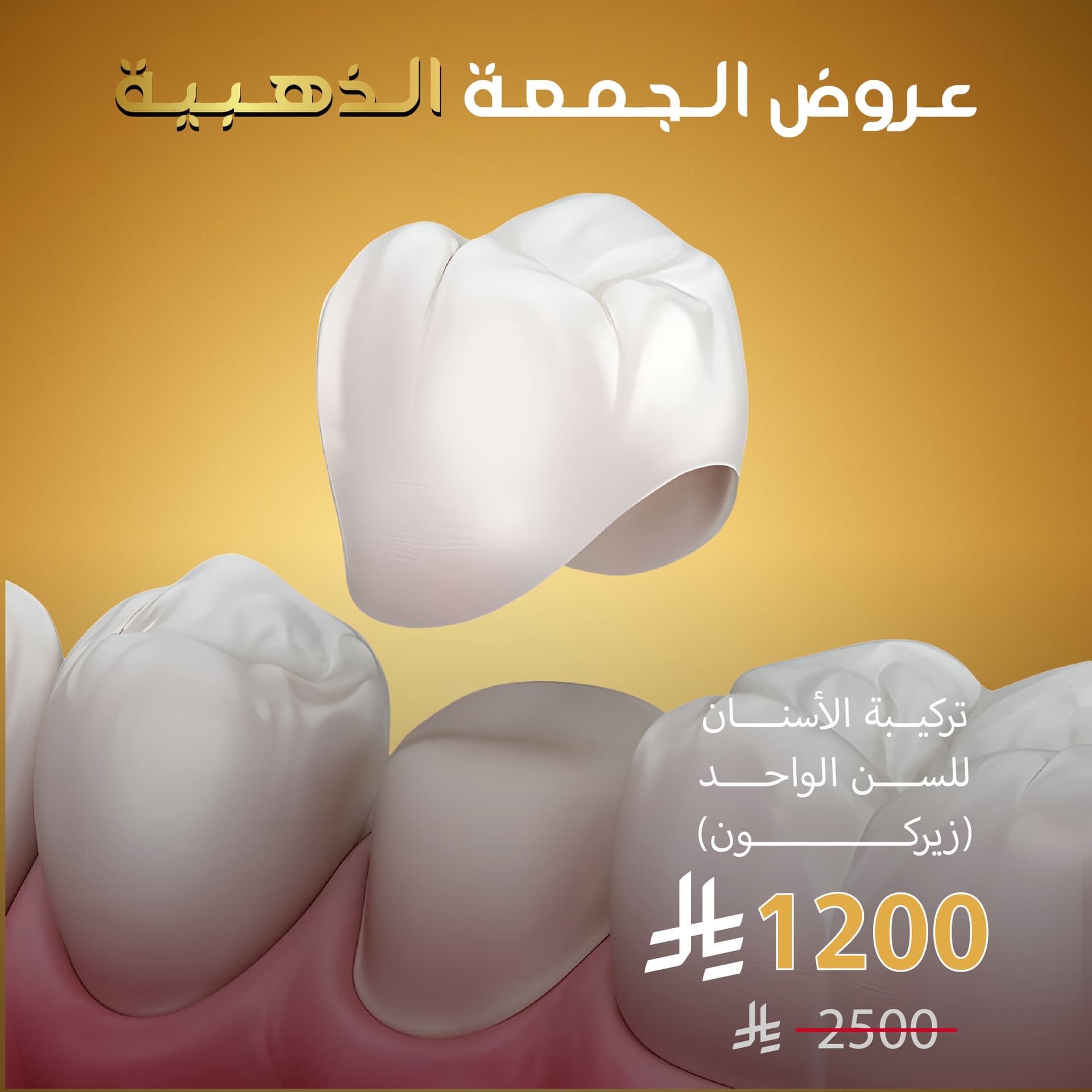 (زيركون) تركيبة الأسنان للسن الواحد