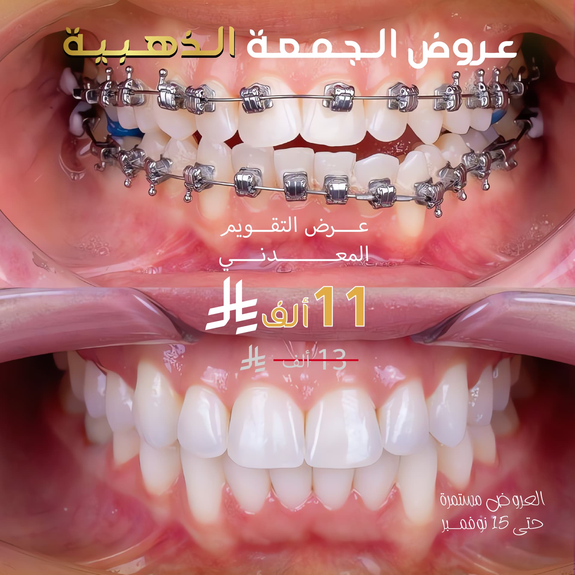 عرض التقويم المعدني